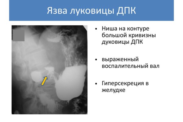 Список луковых tor сайтов
